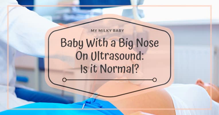 The Truth Behind Baby With Big Nose on 3D Ultrasound Header