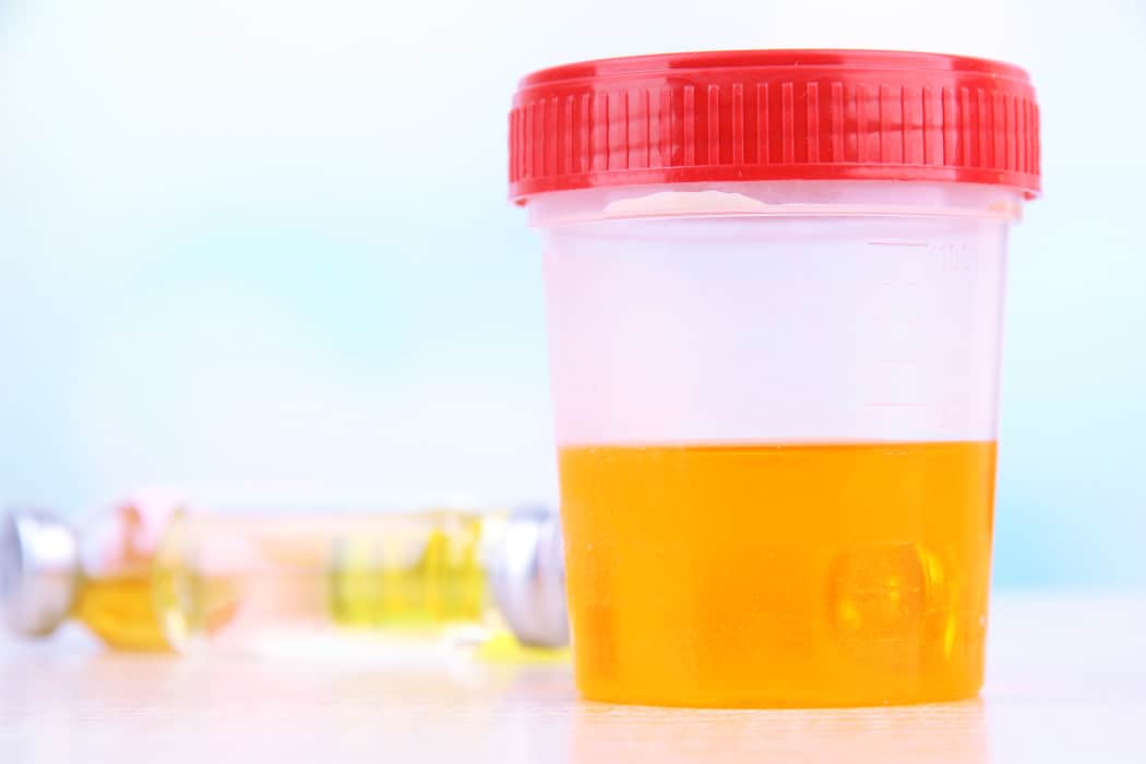 All What You Need To Know About The Pine Sol Pregnancy Test Header